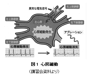 心房細動(1)