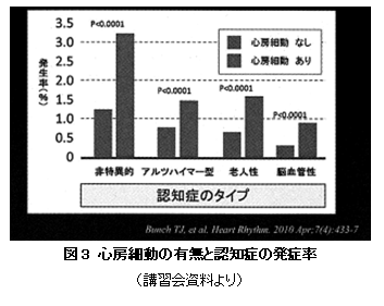 心房細動(3)